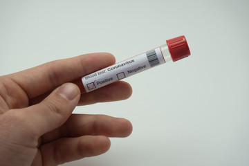 Obraz premium A gloved hand is holding a blood test for the coronavirus. The test tests positive for 2019-NcOv. The hand is placed on a white background.