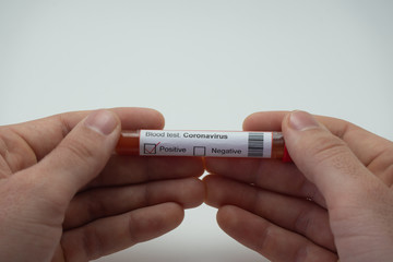 In the foreground a blood test of the coronavirus held by two hands.  The blood tube indicates...