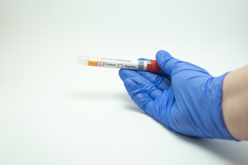 Obraz premium Hand holding a blood test. The blood test is from Coronavirus, 2019-NcOv. Tests positive for coronavirus. The glove is blue and the background is white.