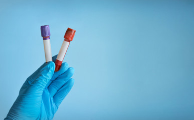Laboratory doctor’s hand holding EDTA tubes filled with blood for the tests. Laboratory diagnostics. Hematology tests. 