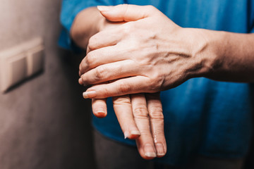 Woman lubricates tired and dry hands from frequent washing with moisturizer