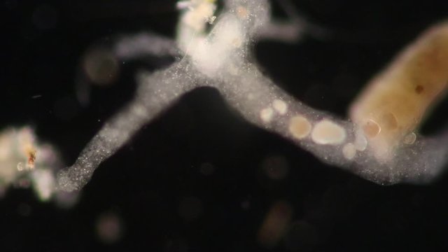 Amoebae move and feed by using pseudopods, which are bulges of cytoplasm formed by the coordinated action of actin microfilaments pushing out the plasma membrane that surrounds the cell.