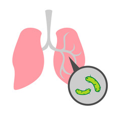 Simple, flat illustration of a lung disease. Pneumonia infographics, drawing for informational, medical poster 