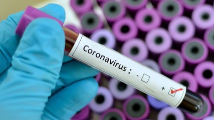 Obraz premium coronavirus