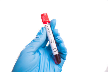 Obraz premium blood sample tube Coronavirus,Covid-19 In the hand, Putts wore blue protective gloves.Isolated on white background
