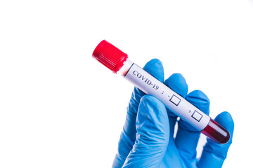Obraz premium blood sample tube Coronavirus,Covid-19 In the hand, Putts wore blue protective gloves.Isolated on white background