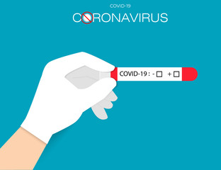 Doctor's hand holds test tube with blood for 2019-nCoV analyzing. Novel Chinese Coronavirus blood test Concept. CoVID-19 Virus outbreak spread.