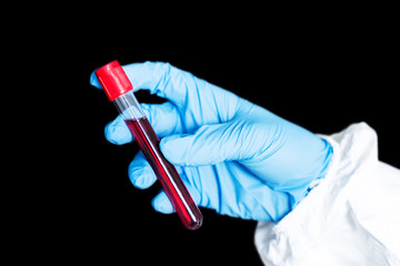 The doctor holds a blood test on a black background. China coronavirus epidemic COVID-19