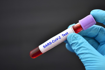 Obraz premium Test tube with blood sample for SARS-CoV-2 or COVID-19 virus test