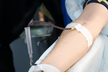 Close up arm of a man who donates blood. Male donor gives blood in a mobile blood donation center....