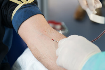 inserts a needle into a vein, close-up, preparation for taking blood test from a vein, mobile blood...