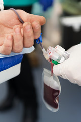 The hand of a man who donates blood. Male donor gives blood in a mobile blood donation center. Blood samples. Hands of the nurse with protective gloves.