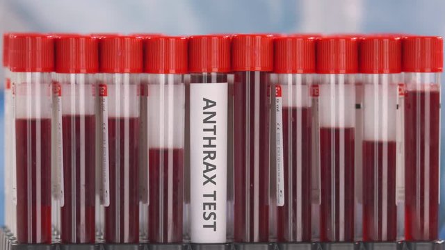 Hand wearing protection glove puts vial with anthrax test in the tube rack
