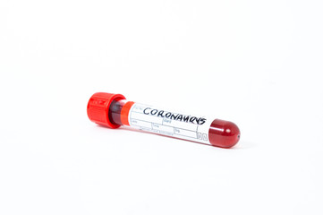 Sample vial for coronavirus testing. Concept of problem with virus, coronavirus, Covid 19 Sars....