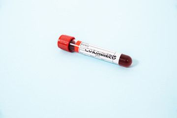 Sample vial for coronavirus testing. Concept of problem with virus, coronavirus, Covid 19 Sars. Performing coronavirus tests, pandemic.