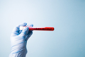 hand in blue medical disposable rubber gloves holds a test tube with red blood, inscription...