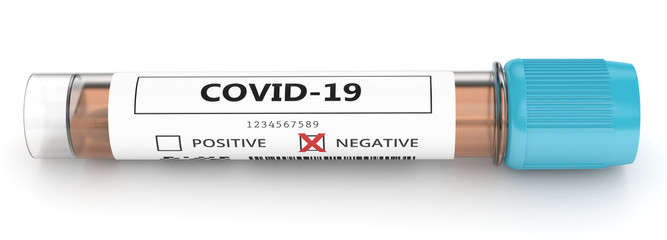 3d render of covid-19 negative nasal swab laboratory test © Aleksandra Gigowska