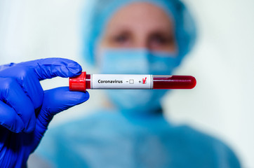 Medical laboratory assistant holding test tube with positive Coronavirus test blood sample.