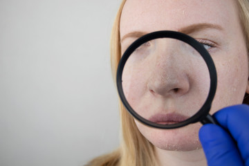 A woman examines dry skin on her face. Peeling, coarsening, discomfort, skin sensitivity. Patient at the appointment of a dermatologist or cosmetologist, selection of cream for dryness