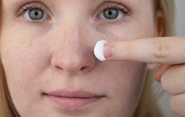 A woman examines dry skin on her face. Peeling, coarsening, discomfort, skin sensitivity. Patient at the appointment of a dermatologist or cosmetologist, selection of cream for dryness