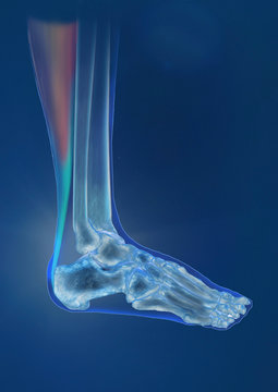 Achillissehne Tendor, Anatomie, Illustration, Computertomographie