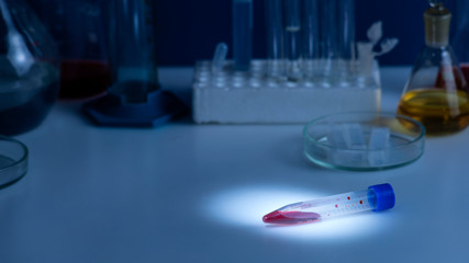 Accent light Test tubes with blood samples on table
