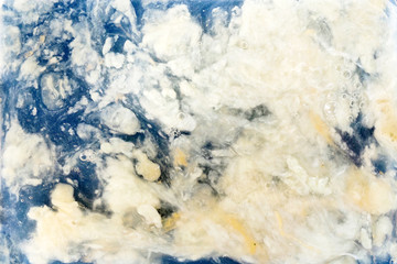 Discharge from the lungs with a viral disease background, coughing sputum, expectoration, pneumonia. Snot texture