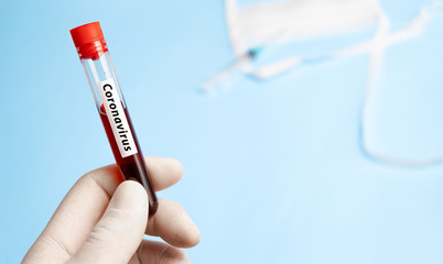 Fototapeta premium Doctor holding test tube with blood for 2019-nCoV analyzing. Coronavirus disease COVID-19 pandemic