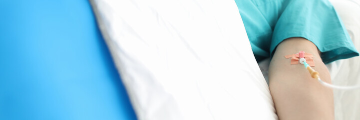 Focus on mans body and arm with iv. Medical treatment and aid for person lying in bed of hospital. Human with intravenous drip in clinics recovering from illness