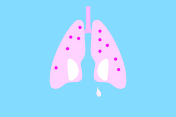 Lungs with white stains symbolizing eyes with a tear and virus flat design illustration