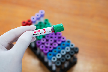 Cropped Hand Of Person Holding Covid-19 or Coronavirus Test Tube Over yellow Background