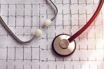 Medical stethoscope and ecg results as a graph. Heart condition in graphics.