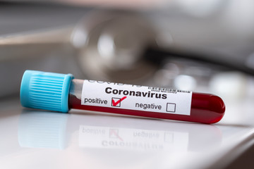 Obraz premium Blood sample for coronavirus testing
