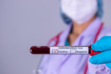 Obraz premium Positive COVID-19 test and laboratory sample of blood testing for diagnosis Corona virus infection. COVID-19 concept.