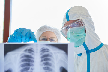 Mediziner mit Röntgenbild eines Covid-19 Patienten