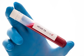 Test tube in male hand, doctor in medical mask holding vial with red liquid. Concept blood sample,...