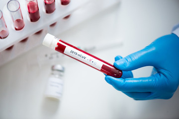 Close-up of test tube with a blood test and a coronavirus vaccine in hands of doctor. Concept of...