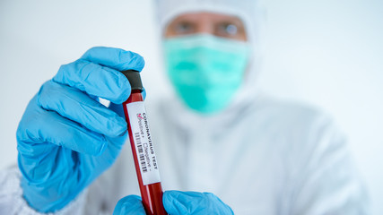 Laboratory technician man hold blood sample tube for corona virus test. Covid-19