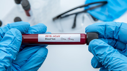Test tube with negative blood sample for COVID-19, coronavirus from Wuhan
