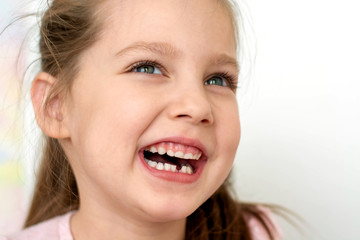 a happy girl in a pink school- age t-shirt without a front tooth laughs. To close. Diphyodont. Isolated on a white background. health