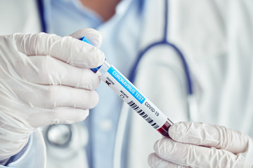 Doctor with positive blood sample for coronavirus disease, Covid-19