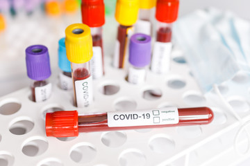 COVID-19 test tube and laboratory sample of blood testing for diagnosis new Corona virus infection(novel corona virus disease from hospital background. Pandemic infectious concept