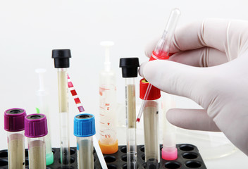 Coronavirus disease (COVID-19) research. Blood test. Regular blood testing is one of the most important ways to keep track of your overall physical well-being.