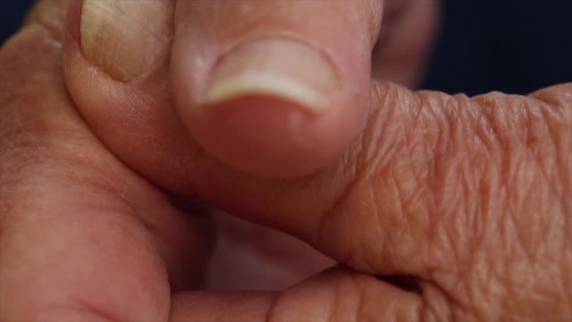 Closeup of Elderly Hands