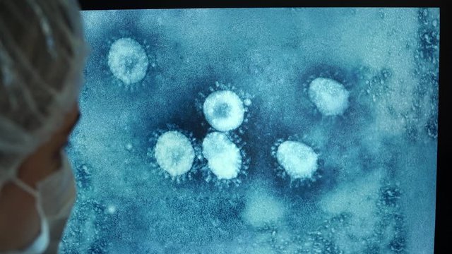 Team of doctors at computer monitor screen in laboratory analyzes image of virus several times enlarged, showing with hands in medical gloves on Coronovirus close-up.