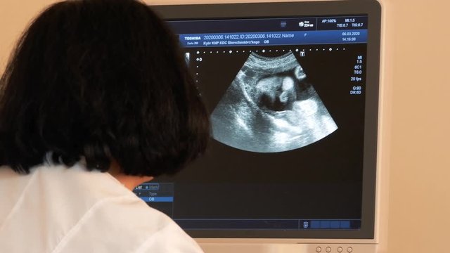 Doctor does utrasound sonogram procedure to a pregnant woman. Ultrasound at 7 months of pregnancy. Embryo head on screen 4k