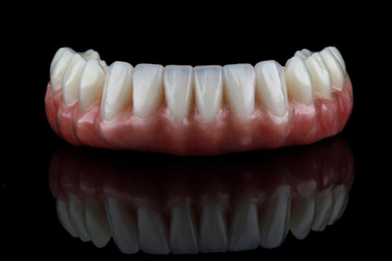 beautiful dental lower jaw prosthesis with pink gum on black glass with reflection