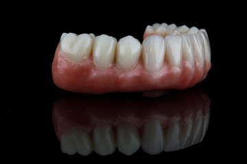 dental lower jaw prosthesis with pink gum on black glass, subject dental