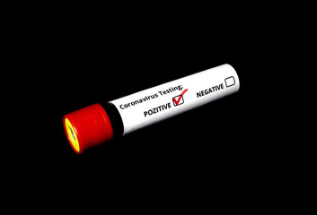 Covid-19, Coronavirus blood test