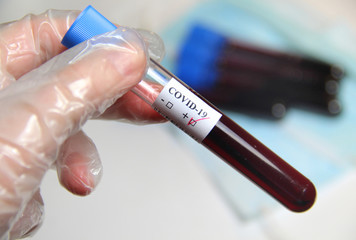 COVID-19  and nurse with blood test